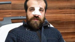Sağlık Ocağında Doktor ve Öğretmene Saldırdılar