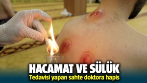 Hacamat ve sülük tedavisi yapan sahte doktora hapis