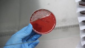 Uzun süre kullanılan maskedeki bakteriler laboratuvarda gözler önüne serildi