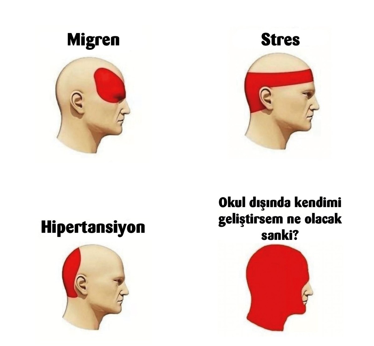 migren